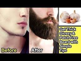 8 Tips To Grow Beard Fast Get Rid Of Patches Urdu Hindi Https Www Fashionhowtip Com Post 8 Tips Beard Growing Tips Beard Growth Tips Grow Beard Faster