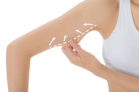 kol liposuction uygulamasina ne zaman ihtiyac duyulur