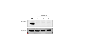 Maybe you would like to learn more about one of these? Kctd10 Antibody That Works Well In Western Blot Experiments Biocompare Antibody Review