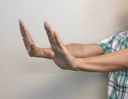 This phenomenon is found to be occurring with. Core Concepts Diagnosis And Management Of Hepatic Encephalopathy Management Of Cirrhosis Related Complications Hepatitis C Online