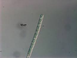 Image result for Peponium sp. A