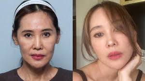 Kini Berumur 54 Tahun, Jeremy Thomas dan Istri Ikut Tren Oplas serta Face  Lift ke Korea Selatan