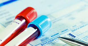 2 have your ammonia levels tested. Elevated Blood Ammonia Level Symptoms Causes Treatments