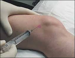 Concerns about tissue damage are greater for younger patients because they have young, healthy joint tissues. Why Knee Injections Don T Work The Knee Pain Guru