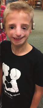 children's craniofacial association: empowering and giving hope to  individuals and families affected by facial differences