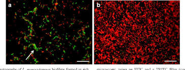Recently a listeria outbreak in the uk was traced to hospitals serviced by food vendor the good food chain. Figure 2 From Listeria Monocytogenes Can Form Biofilms In Tap Water And Enter Into The Viable But Non Cultivable State Semantic Scholar