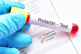 Image result for Prolactin