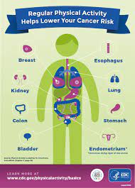 Physical Activity And Cancer | Physical Activity Basics | Physical Activity  | Dnpao | Cdc