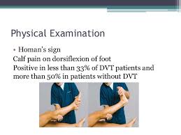 Deep Vein Thrombosis