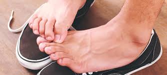 For the problem of athlete's foot, this has been a very helpful oil. Athlete S Foot Common Signs Natural Treatments Dr Axe