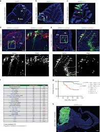 Section 8 benefits are administered by the u.s. Modeling Medulloblastoma In Vivo And With Human Cerebellar Organoids Nature Communications