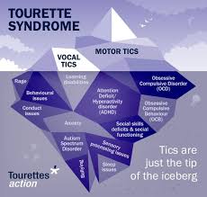 Image result for Tic Management