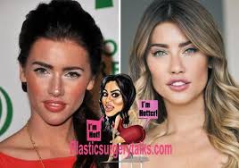 Jacqueline Macinnes Wood Plastic Surgery Before After Jacqueline Macinnes Wood Plastic Surgery Plastic Surgery Before After