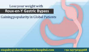 Roux En Y Gastric Bypass In India Bariatric Surgery India Low Cost Roux En Y Gastric Bypass In India Best Ho Bariatric Surgery Best Hospitals Gastric Bypass