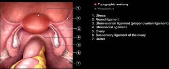 Demonstration of pelvic anatomy by modified midline transection that maintains intact internal pelvic organs. Laparoscopic Management Of Ovarian Disease