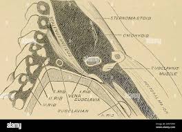 Image result for phlegmon on face)