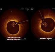 Portable OCT Imaging System: Mobile/Mobile-E | Manufacturer ...