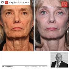 نمایه ‏‎Scott Engel, MD, FACS‎‏‎