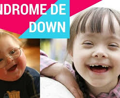 Pilar mostalac, directora de la fundación john langdon down, habló sobre el día mundial del síndrome de down. 21 De Marzo Dia Mundial Del Sindrome De Down Toluna