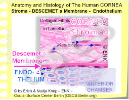 Epithelial basement membrane dystrophy is also sometimes referred to as either of the following: The Cornea Ocular Surface Center Berlin