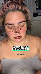 Gen Z Lip Trend Gone Wrong