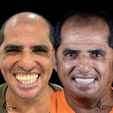 ✨Transforma tu sonrisa 😃 con ORTODONCIA ✨ En manos de un especialista el  Dr.Marvin Benavides ✓ Contamos con diferentes tipos de brackets ✓ Sin Prima  ✓ Cómodas cuotas ✓ Contamos con centro