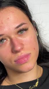 Greenville Sc Before and After