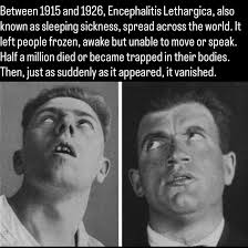 THE FORGOTTEN EPIDEMIC The “sleepy sickness” epidemic of 1918 Near the end  of World War I, a bizarre disease known as “sleepy sickness,” or lethargic  encephalitis, was contracted by millions of people