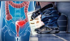 The small intestine, also known as the small bowel, runs from your stomach to your large intestine (colon). Bowel Cancer Symptoms What A Healthy Stool Looks Like Express Co Uk