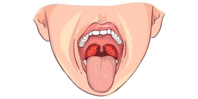 Lesiones bucales que no cierran? Alerta de cáncer - OdontoVida
