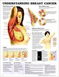 Understanding Breast Cancer Anatomical Chart Company