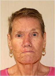 Blount County DA to push for 'Edith's Law' after Jane 'Sally' Doe  identified as mentally disabled Georgia woman