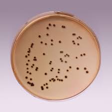 Image result for Shigella