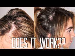 You should look at positive and negative reviews so that you can see all of the benefits and drawbacks to buying an rogaine foam for womens review 4 from that seller. Does Rogaine Work On Women Jobs Ecityworks