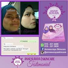 Hati kau keras roy sampai nak tercabut plate number tu. Viral Oh Viral Mencuri Lagi Hati Kau Keras Roy
