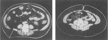 images?q=tbn:ANd9GcTJ9JOcMCU4Zm980l8C474E54mV6IrsmlzCgW1ISTruT8stchRIzw