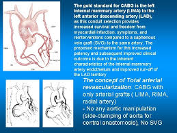 A proximal dissection within the internal mammary artery renders it nonusable. Surgery Of Ischemic Heart Disease Common Types Of