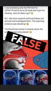 Polymerase chain reaction tests, known as pcr, are the most common and most accurate tests for determining whether someone is currently infected the novel coronavirus pcr test works by starting with a throat swab or sputum sample from a patient, amplifying that specimen in a machine, and then. Getting A Coronavirus Test Don T Believe The Myths And Conspiracy Theories About How Pcr Test Kits Work Abc News