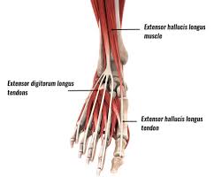 Discover the cause of your top of foot pain and get a custom treatment plan to get better. Extensor Tendonitis Tendinopathy Symptoms Causes And Treatment