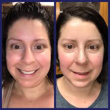 Unexpected skincare discovery for puffy face and redness