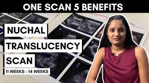 Booking/dating scan from hundreds of plastic was and an. 5 Benefits Of Nuchal Translucency Scan Nt Scan Pregnancy Scan 11 14 Weeks Youtube