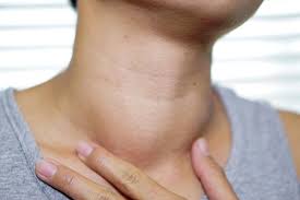 As the tumor gets larger, other symptoms of thyroid cancer in women may begin to occur, including This Thyroid Disorder May Be A Marker For Covid 19 Infection