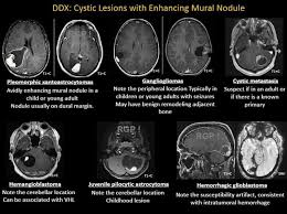 Pin By Mark Maynard On Information Medical Ultrasound Radiology Mri Brain