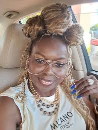 Living with discoid lupus