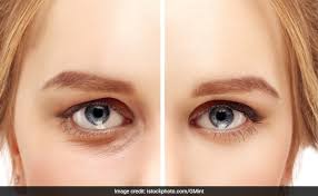 Jun 07, 2021 · typically found in foods such as cauliflower, tomatoes, and leafy greens, vitamin k is one of the best nutrients to ingest for reducing the appearance of under eye bags. 5 Foods That Help Get Rid Of Dark Circles Ndtv Food