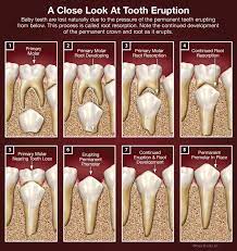 Root Canal Treatment For Children