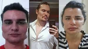 Los cirujanos plásticos más recomendados de tijuana: El Cirujano Del Terror Pacientes Compartieron Fotos De Como Les Deformo La Cara Canal 9 Televida Mendoza