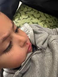 What to do when a nonverbal autistic child gets injured at school and  receives conflicting stories about the incident?