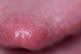 La lingua di chi è affetto da scarlattina è prima biancastra (a fragola bianca), poi diventa rossa con le papille in evidenza (a fragola rossa). Lingua A Fragola Nei Bambini Cause Principali E Cosa Fare