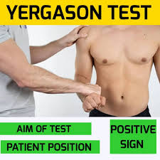 Image result for Yergason Test